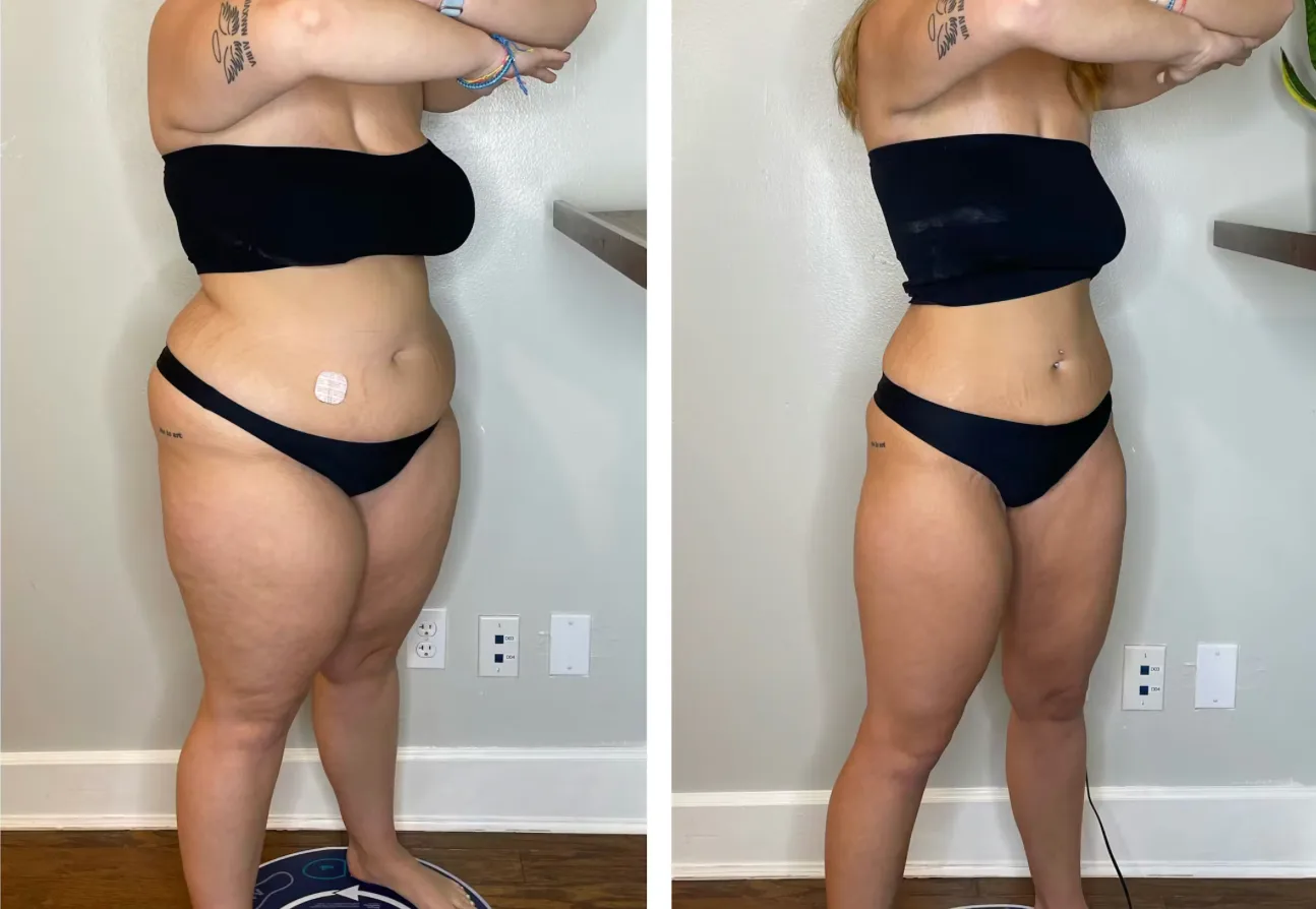 WL Before and After 1.1